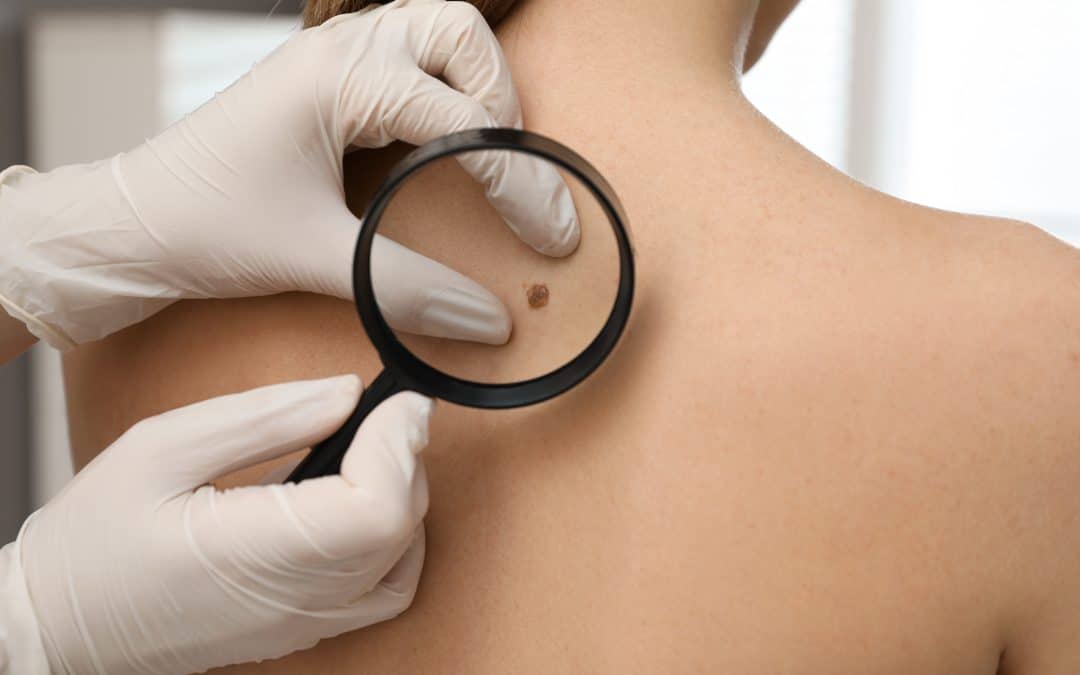 Kako prepoznati opasne madeže